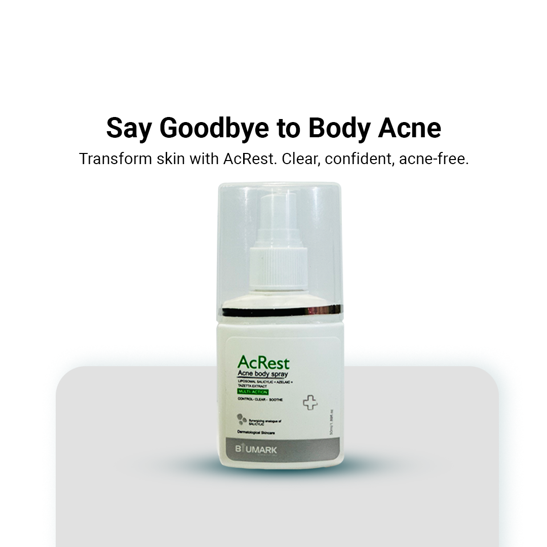 AcRest Acne Body Spray